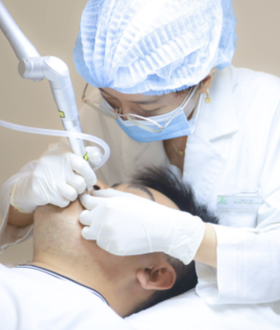 Điều trị mụn thịt bằng Laser Fractional CO2 tại Pro Skin