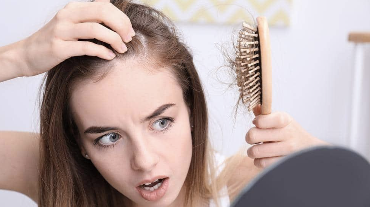 Người bị rụng nhiều t&oacute;c, t&oacute;c thưa dần theo thời gian