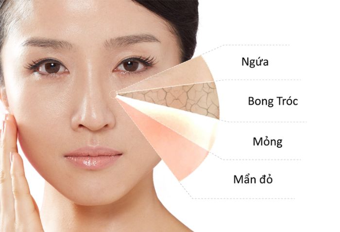 Ph&ugrave; hợp với mọi loại da