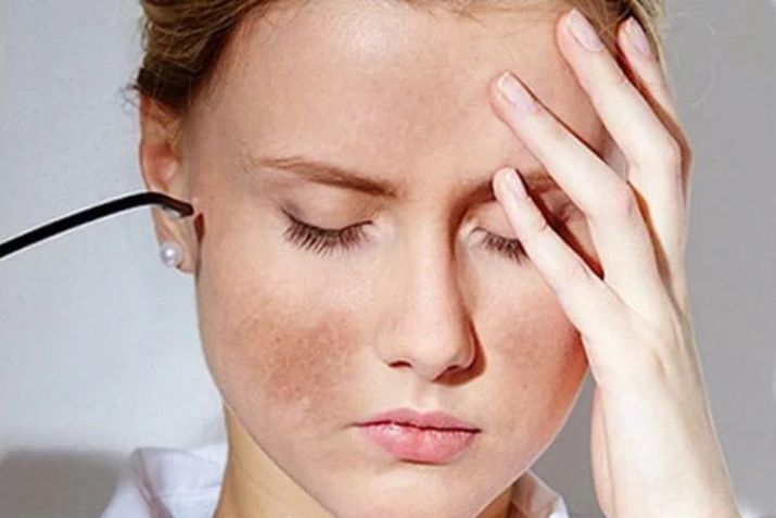 C&oacute; cần đến ph&ograve;ng kh&aacute;m trị n&aacute;m sạm da