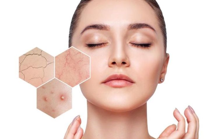 Ph&ugrave; hợp với da nhạy cảm - Kh&ocirc;ng g&acirc;y bong tr&oacute;c mạnh
