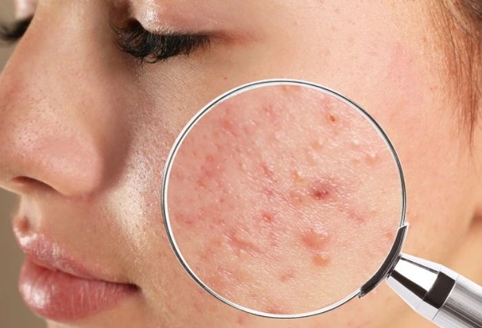 Kh&aacute;m da liễu l&agrave; g&igrave;?