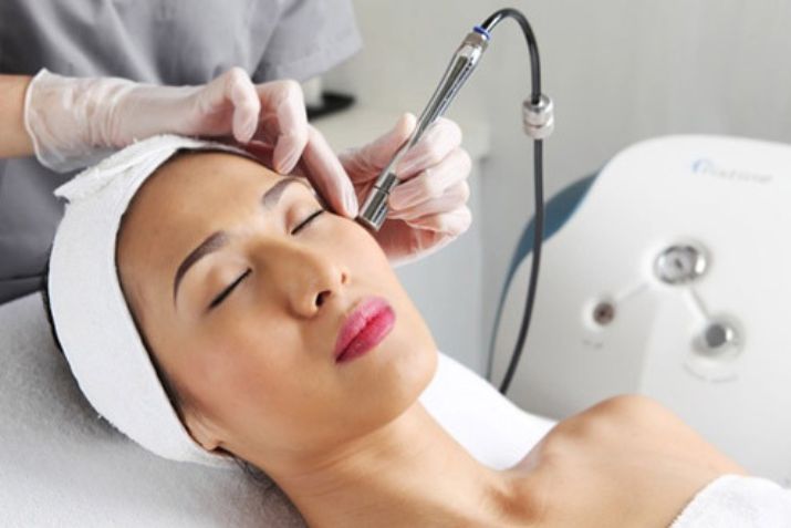 Đốt mụn thịt bằng laser