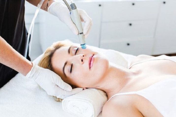 Tẩy nốt ruồi bằng Laser - Giải pháp làm đẹp an toàn và hiệu quả