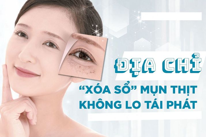 Bật mí Top 5 địa điểm trị mụn thịt uy tín tại TP.HCM có thể bạn chưa biết