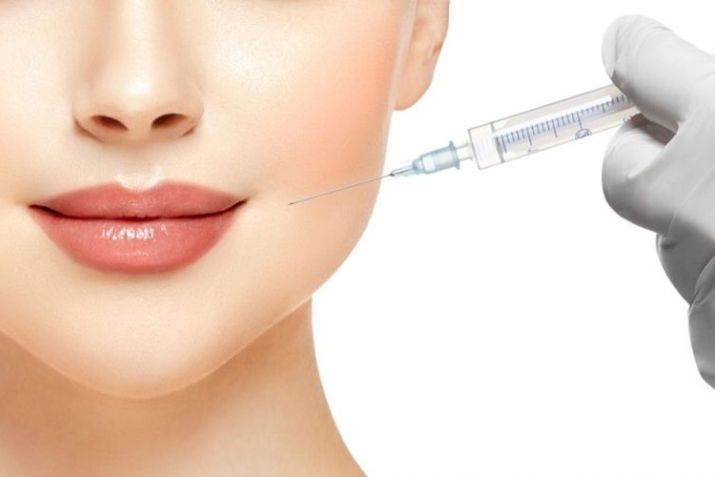 Những lưu ý trước và sau khi tiêm meso là gì?