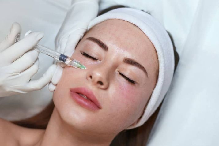 Tiêm meso là gì? Sự khác biệt giữa tiêm meso và những phương pháp làm đẹp trên thị trường