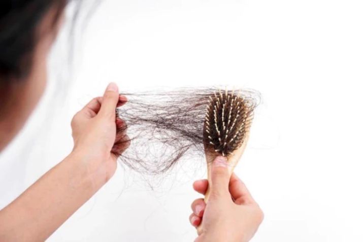 Bị rụng tóc liên miên? Đến ngay Phòng khám chuyên khoa da liễu kỹ thuật cao PRO SKIN!