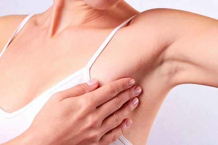 Những điều cần biết về mụn thịt ở nách trong tuổi dậy thì
