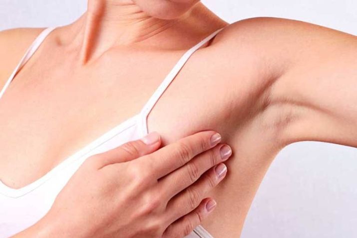 Đừng chủ quan với mụn thịt ở nách! Cần lưu ý những gì?