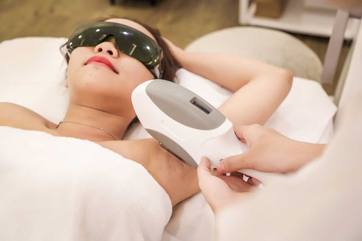 Giải pháp triệt lông vĩnh viễn tại PRO SKIN - Phòng khám da liễu quận Bình Thạnh