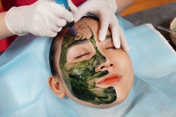Peel da vi tảo - Bí quyết trẻ hóa da & Các loại peel da phổ biến hiện nay