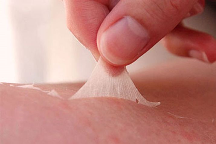 Peel da và lột da: Đâu là phương pháp làm đẹp an toàn và hiệu quả cho làn da của bạn?