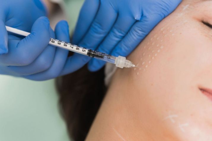 Giá tiêm meso mới nhất - Bảng giá tiêm meso năm 2025 tại Pro Skin