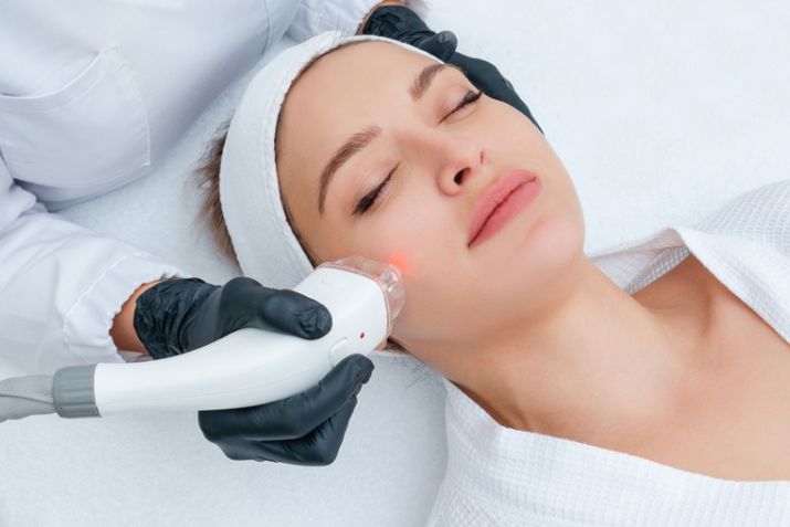 Đốt mụn thịt bao lâu thì hết thâm? Giải đáp chi tiết và hướng dẫn chăm sóc da đúng cách