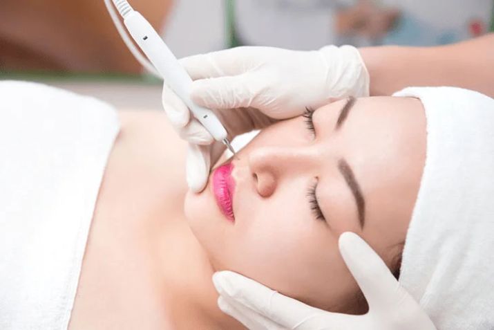 Đốt mụn thịt bao lâu thì lành? Bao lâu thì được trang điểm trở lại?