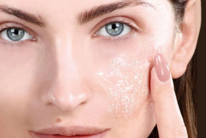 Peel da là gì? Phân loại các cấp độ peel da và đối tượng phù hợp