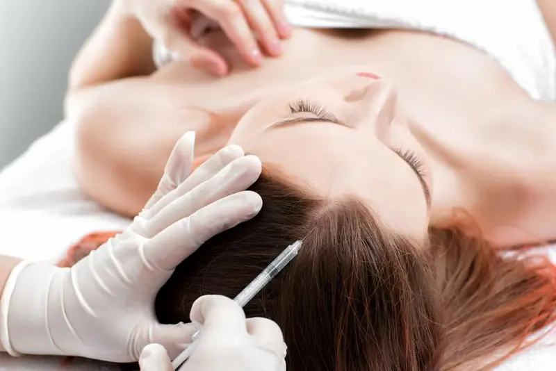 Tiêm meso có thật sự giúp mọc tóc? Những điều cần biết về tiêm meso