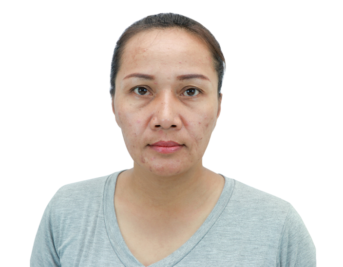 Trước - Tre-hoa-da