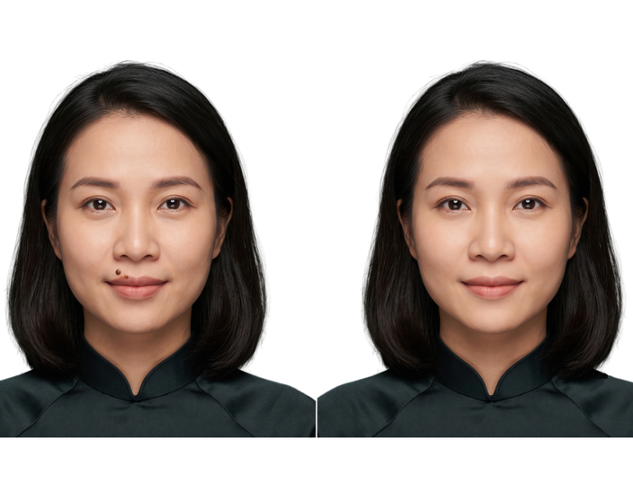 Sau - Hình ảnh trước và sau điều trị
