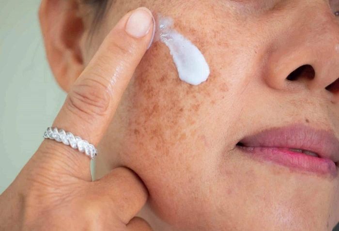 Sử dụng c&aacute;c sản phẩm trị n&aacute;m