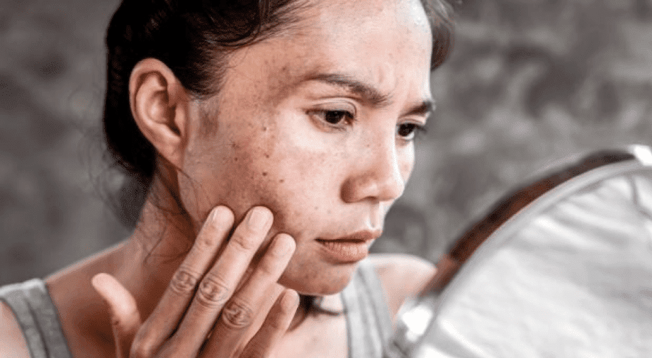 Khói bụi làm ảnh hưởng đến da