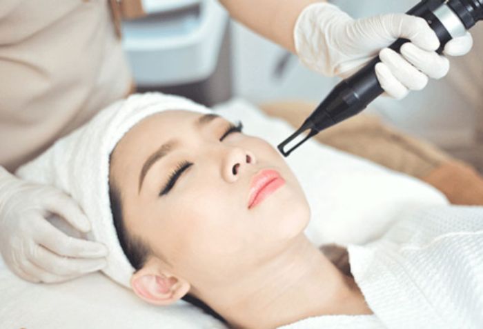 Kỹ thuật đốt mụn thịt
