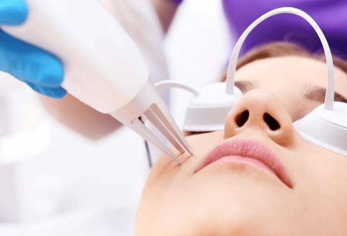 Trường hợp nhẹ - chỉ cần 1 lần đốt duy nhất