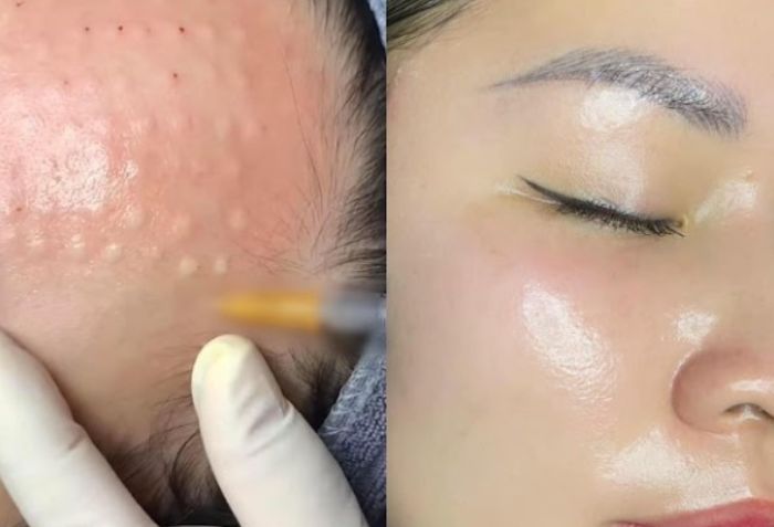 Trẻ h&oacute;a v&agrave; căng b&oacute;ng da