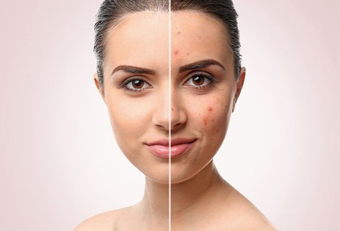 L&agrave;m s&aacute;ng da - Cải thiện sắc tố v&agrave; mờ th&acirc;m hiệu quả