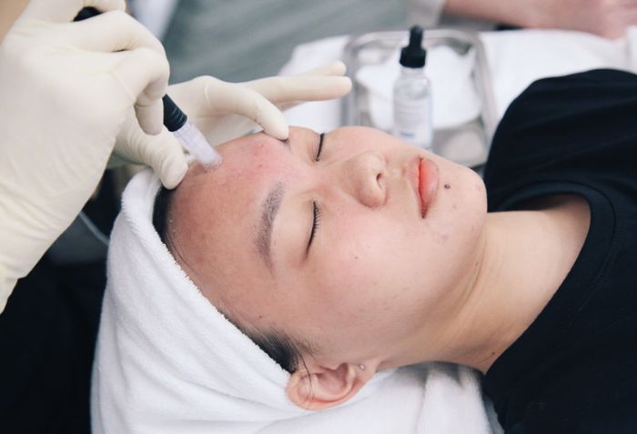 Tại sao n&ecirc;n nặn mụn ở ph&ograve;ng kh&aacute;m da liễu thay v&igrave; tự xử l&yacute; tại nh&agrave;?