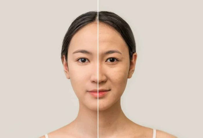 Tăng sinh collagen - Ngăn ngừa l&atilde;o h&oacute;a sớm