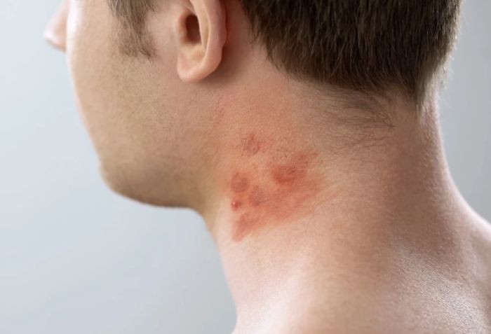 Khi n&agrave;o n&ecirc;n đi kh&aacute;m da liễu ở TP.HCM?