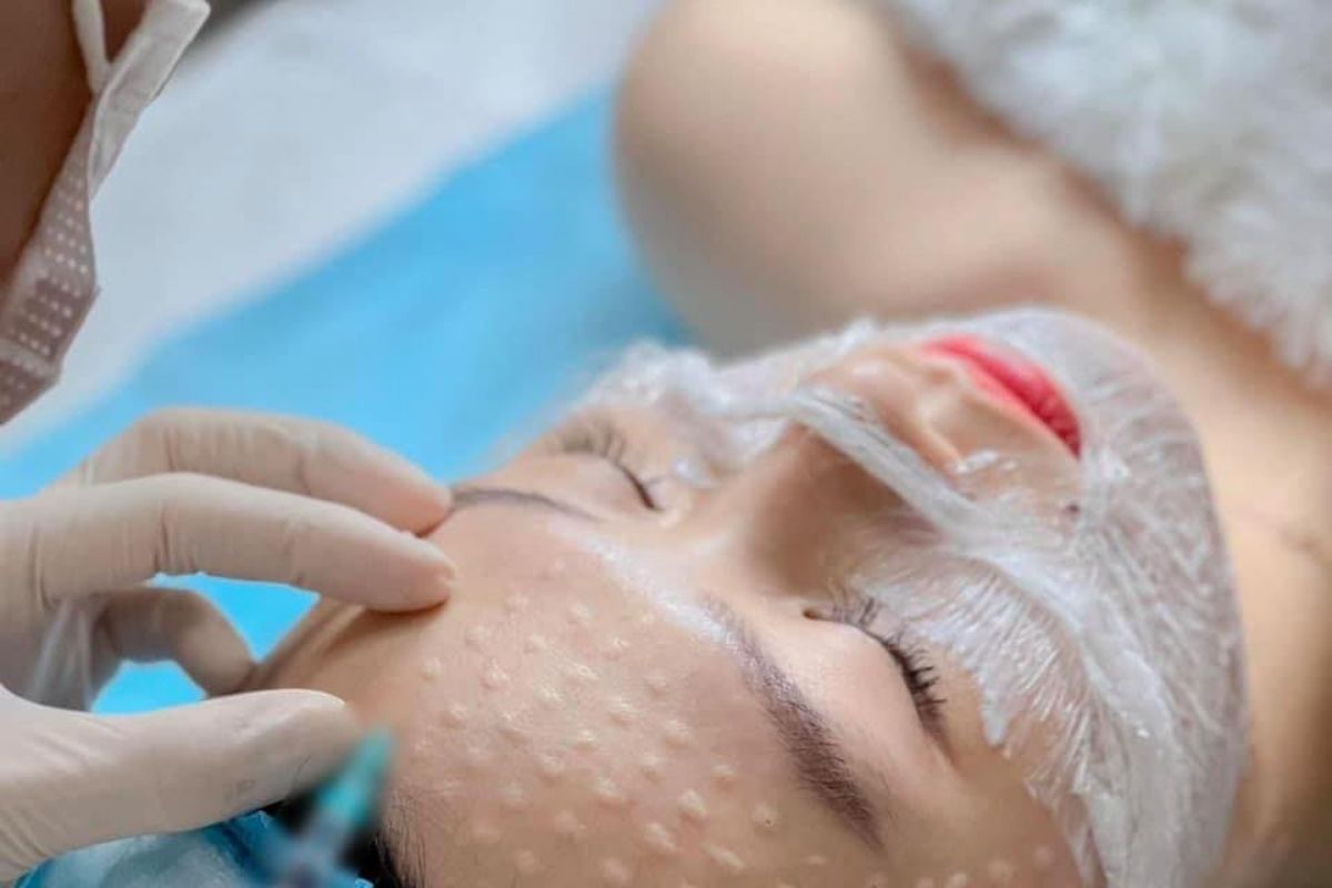 Ti&ecirc;m Meso mang lại l&agrave;n da căng b&oacute;ng, đ&agrave;n hồi