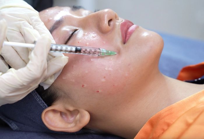 C&ocirc;ng nghệ v&agrave; kỹ thuật thực hiện
