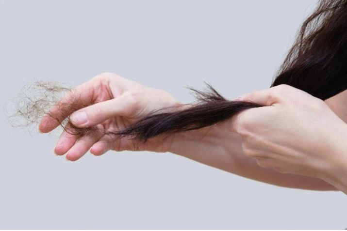 T&oacute;c rụng nhiều