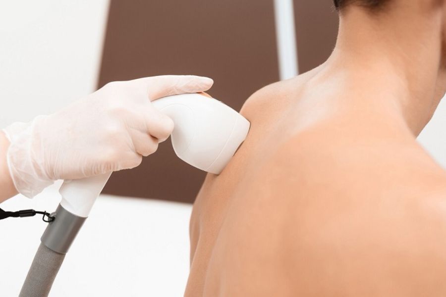 Trị mụn thịt ở lưng