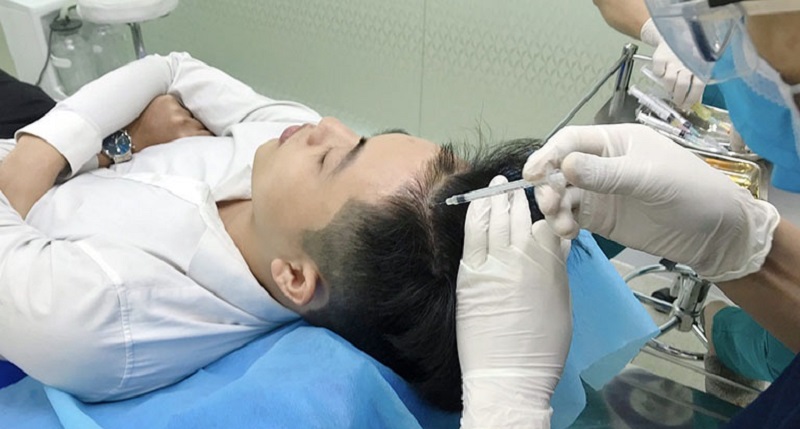 Trị rụng t&oacute;c tại ph&ograve;ng kh&aacute;m